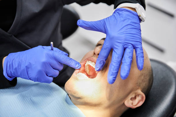 Best Emergency Wisdom Teeth Removal in Inwood, FL